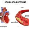 Join BP, DIABETES AND STROKE CURE WhatsApp Group